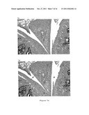 THERAPEUTIC AND PROPHYLACTIC AGENTS FOR ARTHRITIS diagram and image