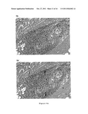 THERAPEUTIC AND PROPHYLACTIC AGENTS FOR ARTHRITIS diagram and image