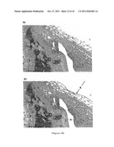 THERAPEUTIC AND PROPHYLACTIC AGENTS FOR ARTHRITIS diagram and image