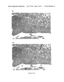 THERAPEUTIC AND PROPHYLACTIC AGENTS FOR ARTHRITIS diagram and image