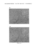 THERAPEUTIC AND PROPHYLACTIC AGENTS FOR ARTHRITIS diagram and image