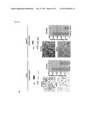 SYNGR4 FOR TARGET GENES OF CANCER THERAPY AND DIAGNOSIS diagram and image