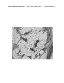 TECHNIQUE FOR REGULATING REGENRATION OF TISSUE OR FAULTY OR ABNORMAL PART     IN ORGAN USING NELL-1 diagram and image