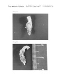 TECHNIQUE FOR REGULATING REGENRATION OF TISSUE OR FAULTY OR ABNORMAL PART     IN ORGAN USING NELL-1 diagram and image