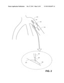 APO A-I MIMETIC PEPTIDES AND METHODS OF TREATMENT diagram and image