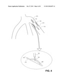 APO A-I MIMETIC PEPTIDES AND METHODS OF TREATMENT diagram and image