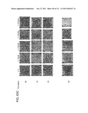 UP TO SIX WEEKS DOSING REGIMEN FOR TREATING ACTINIC KERATOSIS WITH     PHARMACEUTICAL COMPOSITIONS FORMULATED WITH 3.75% IMIQUIMOD diagram and image