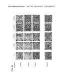 UP TO SIX WEEKS DOSING REGIMEN FOR TREATING ACTINIC KERATOSIS WITH     PHARMACEUTICAL COMPOSITIONS FORMULATED WITH 3.75% IMIQUIMOD diagram and image