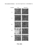 UP TO SIX WEEKS DOSING REGIMEN FOR TREATING ACTINIC KERATOSIS WITH     PHARMACEUTICAL COMPOSITIONS FORMULATED WITH 3.75% IMIQUIMOD diagram and image