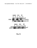 Inhibitors of PIM-1 Protein Kinases, Compositions and Methods for Treating     Prostate Cancer diagram and image