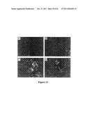 Methods and Compositions for use in Gene Therapy for Treatment of     Hemophilia diagram and image