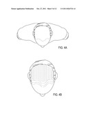 THREADS OF HYALURONIC ACID AND/OR DERIVATIVES, THEREOF, METHODS OF MAKING     THEREOF AND USES THEREOF diagram and image