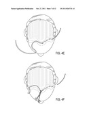 THREADS OF HYALURONIC ACID AND/OR DERIVATIVES, THEREOF, METHODS OF MAKING     THEREOF AND USES THEREOF diagram and image