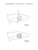 THREADS OF HYALURONIC ACID AND/OR DERIVATIVES, THEREOF, METHODS OF MAKING     THEREOF AND USES THEREOF diagram and image