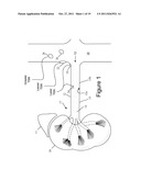 Patterned Denervation Therapy for Innervated Renal Vasculature diagram and image