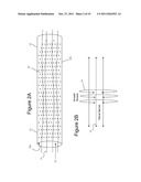 Patterned Denervation Therapy for Innervated Renal Vasculature diagram and image