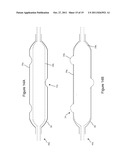 Patterned Denervation Therapy for Innervated Renal Vasculature diagram and image