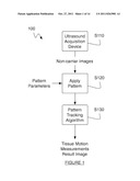 METHOD FOR MEASURING IMAGE MOTION WITH SYNTHETIC SPECKLE PATTERNS diagram and image