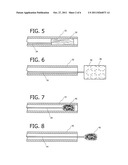 DEVICE AND METHOD FOR CONTROLLING INJECTION OF LIQUID EMBOLIC COMPOSITION diagram and image