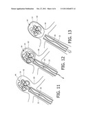 DEVICE AND METHOD FOR CONTROLLING INJECTION OF LIQUID EMBOLIC COMPOSITION diagram and image