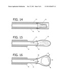 DEVICE AND METHOD FOR CONTROLLING INJECTION OF LIQUID EMBOLIC COMPOSITION diagram and image