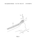 Assisted Positioning Device for Bone Plate diagram and image