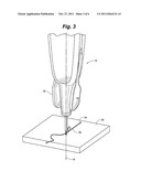 VEIN REMOVAL DEVICE diagram and image