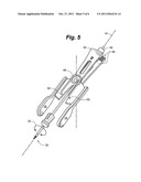 VEIN REMOVAL DEVICE diagram and image