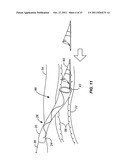 INTRODUCER SHEATHS, THROMBUS COLLECTION DEVICES AND ASSOCIATED METHODS diagram and image