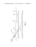 INTRODUCER SHEATHS, THROMBUS COLLECTION DEVICES AND ASSOCIATED METHODS diagram and image