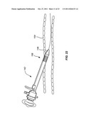 INTRODUCER SHEATHS, THROMBUS COLLECTION DEVICES AND ASSOCIATED METHODS diagram and image