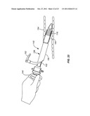 INTRODUCER SHEATHS, THROMBUS COLLECTION DEVICES AND ASSOCIATED METHODS diagram and image