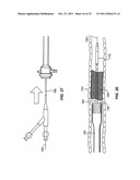 INTRODUCER SHEATHS, THROMBUS COLLECTION DEVICES AND ASSOCIATED METHODS diagram and image