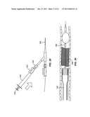 INTRODUCER SHEATHS, THROMBUS COLLECTION DEVICES AND ASSOCIATED METHODS diagram and image