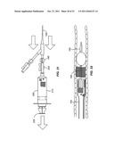 INTRODUCER SHEATHS, THROMBUS COLLECTION DEVICES AND ASSOCIATED METHODS diagram and image