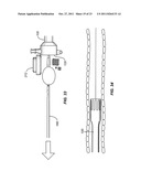 INTRODUCER SHEATHS, THROMBUS COLLECTION DEVICES AND ASSOCIATED METHODS diagram and image