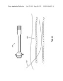 INTRODUCER SHEATHS, THROMBUS COLLECTION DEVICES AND ASSOCIATED METHODS diagram and image