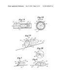 VASCULAR DEVICE FOR EMBOLI AND THROMBI REMOVAL AND METHODS OF USE diagram and image