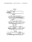 VASCULAR DEVICE FOR EMBOLI AND THROMBI REMOVAL AND METHODS OF USE diagram and image