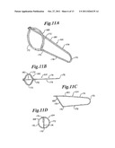 VASCULAR DEVICE FOR EMBOLI AND THROMBI REMOVAL AND METHODS OF USE diagram and image