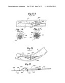 VASCULAR DEVICE FOR EMBOLI AND THROMBI REMOVAL AND METHODS OF USE diagram and image