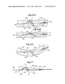 VASCULAR DEVICE FOR EMBOLI AND THROMBI REMOVAL AND METHODS OF USE diagram and image