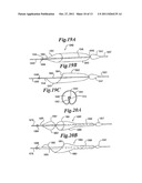 VASCULAR DEVICE FOR EMBOLI AND THROMBI REMOVAL AND METHODS OF USE diagram and image