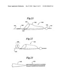 VASCULAR DEVICE FOR EMBOLI AND THROMBI REMOVAL AND METHODS OF USE diagram and image