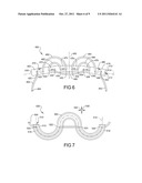 Flexible Anchors for Tissue Fixation diagram and image