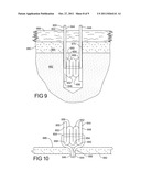 Flexible Anchors for Tissue Fixation diagram and image