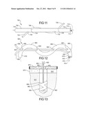 Flexible Anchors for Tissue Fixation diagram and image