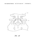 METHOD AND APPARATUS FOR SPINAL STABILIZATION diagram and image