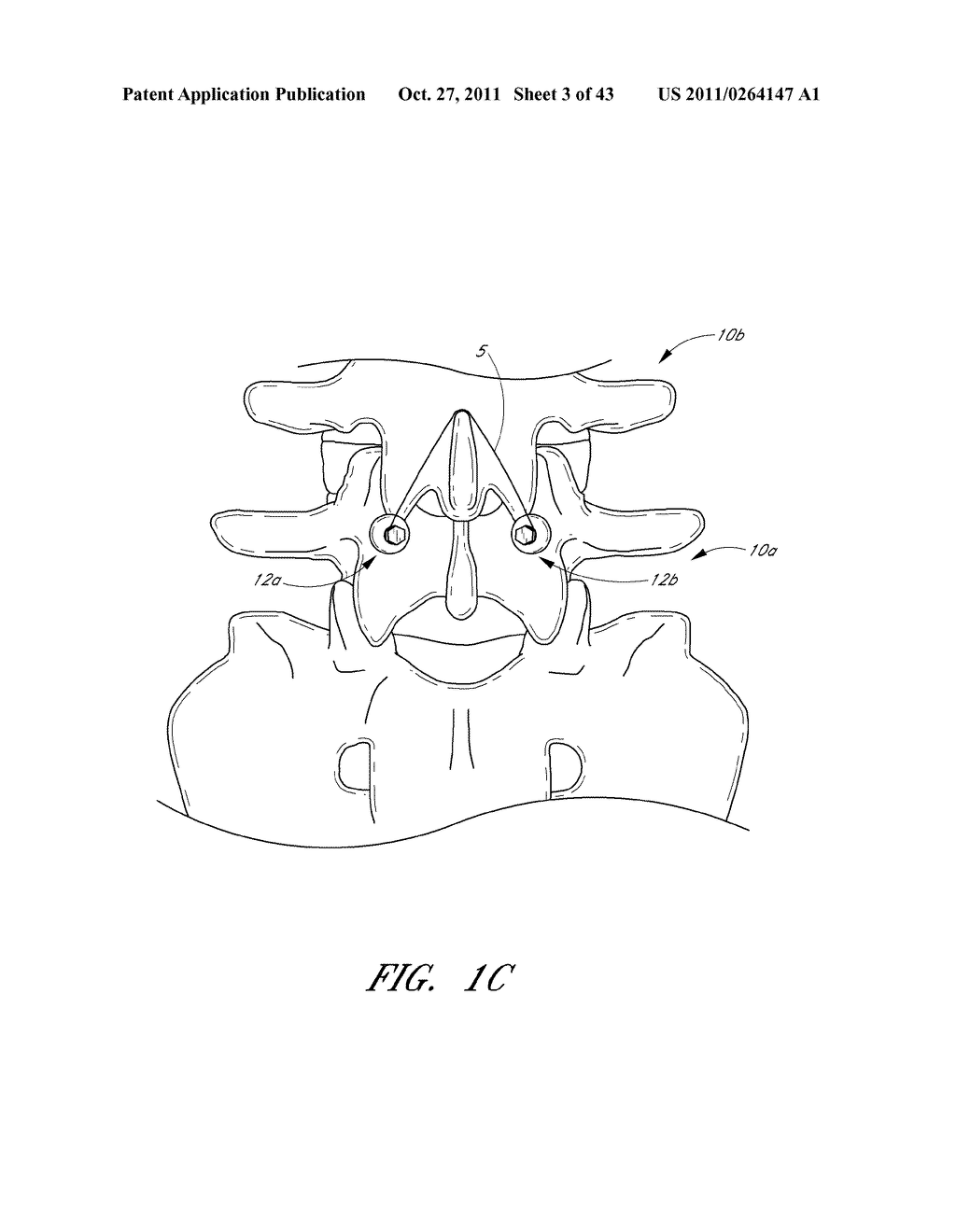 METHOD AND APPARATUS FOR SPINAL STABILIZATION - diagram, schematic, and image 04