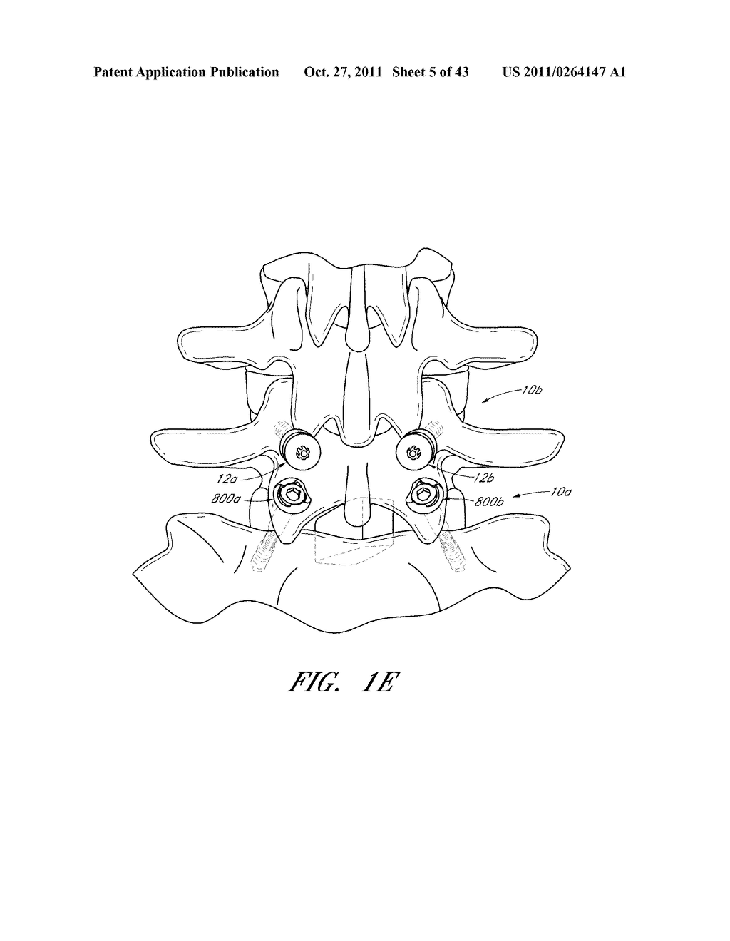 METHOD AND APPARATUS FOR SPINAL STABILIZATION - diagram, schematic, and image 06